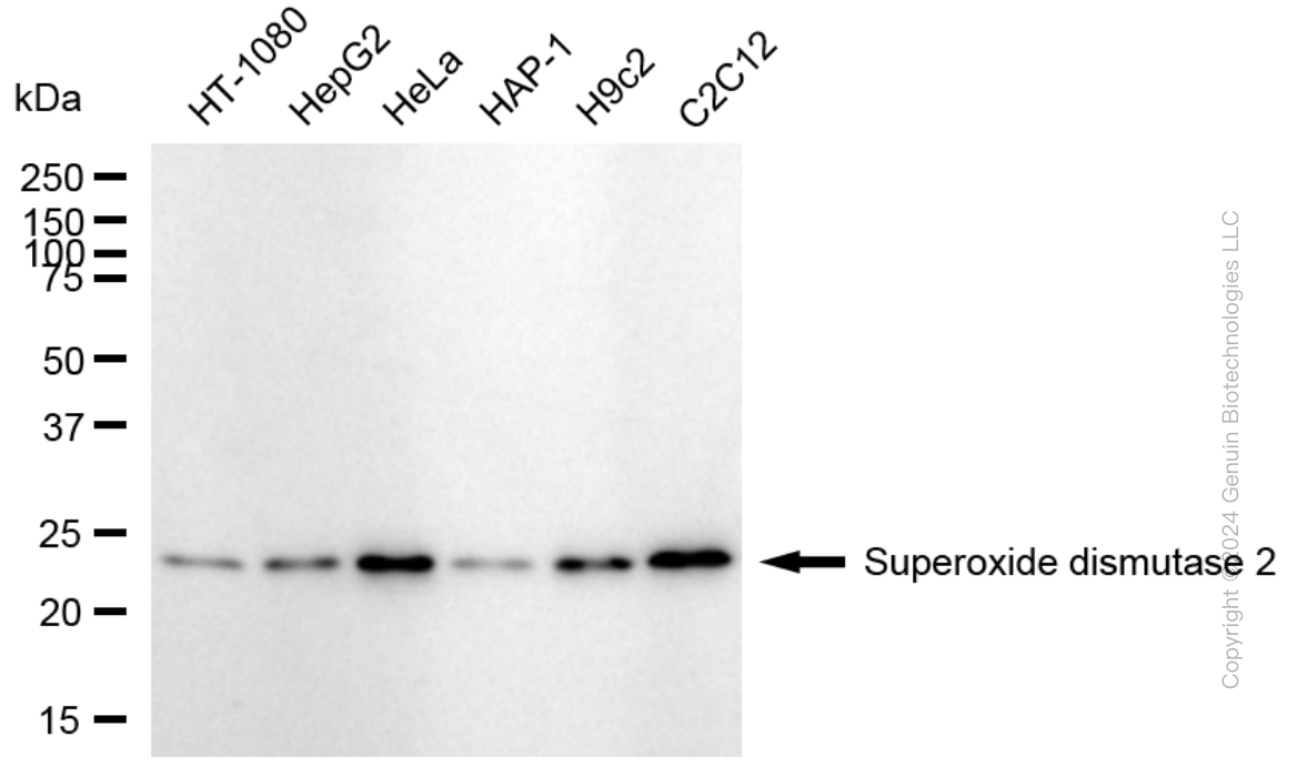 KD-Validated Anti-Superoxide Dismutase 2 Rabbit Monoclonal Antibody ABG1736