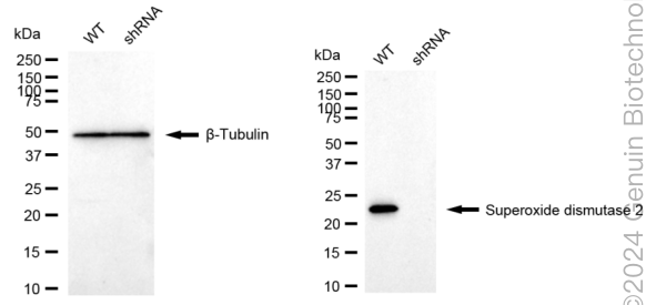 KD-Validated Anti-Superoxide Dismutase 2 Rabbit Monoclonal Antibody ABG1736
