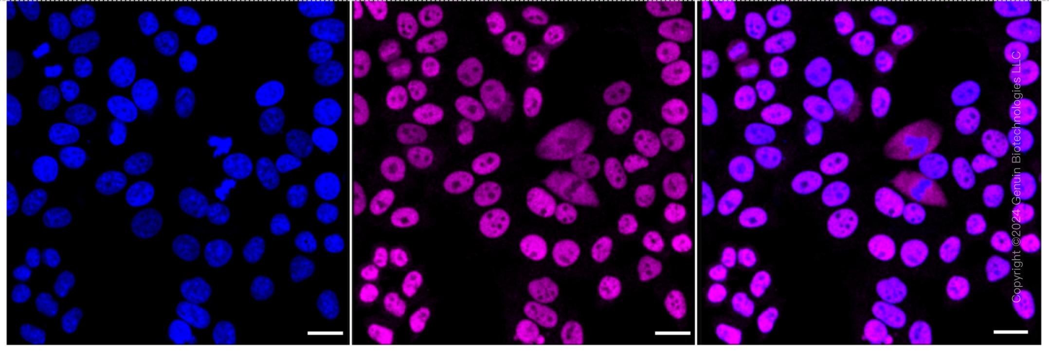 KD-Validated Anti-SMC3 Rabbit Monoclonal Antibody ABG1737