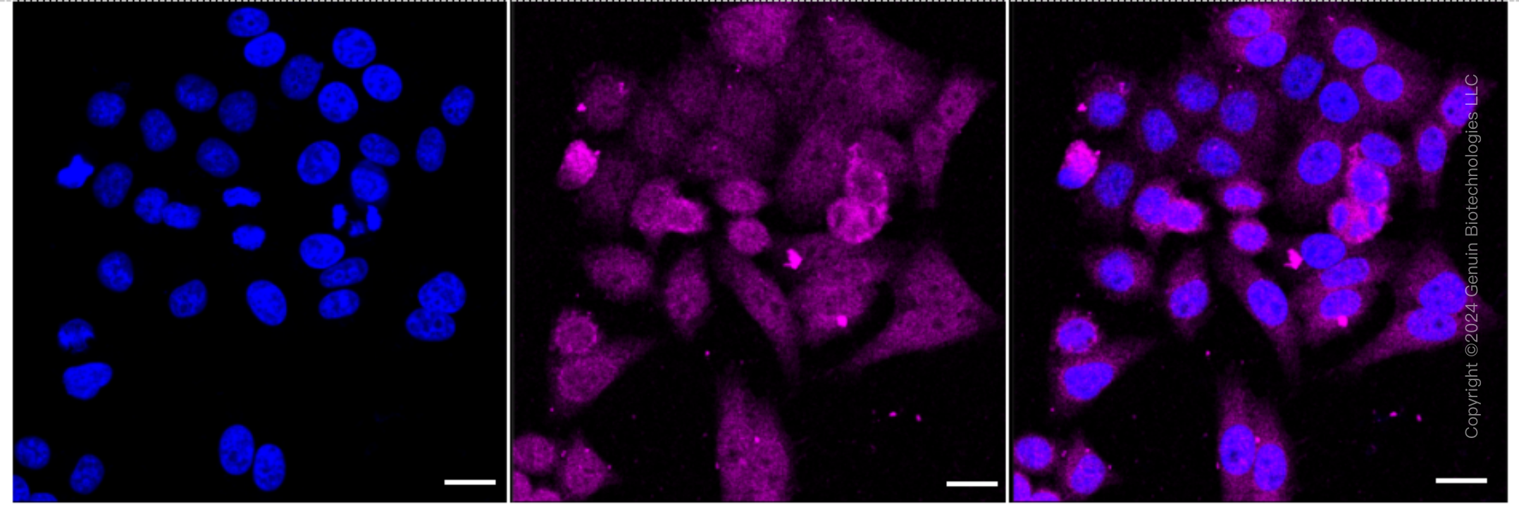 KD-Validated Anti-SMYD3 Rabbit Monoclonal Antibody ABG1739