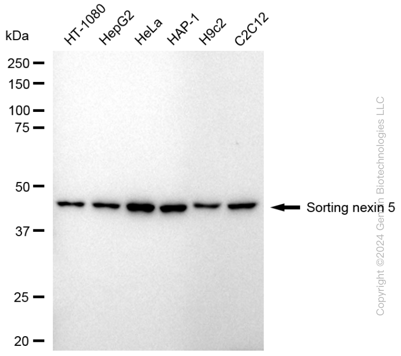 KD-Validated Anti-Sorting Nexin 5 Rabbit Monoclonal Antibody ABG1740