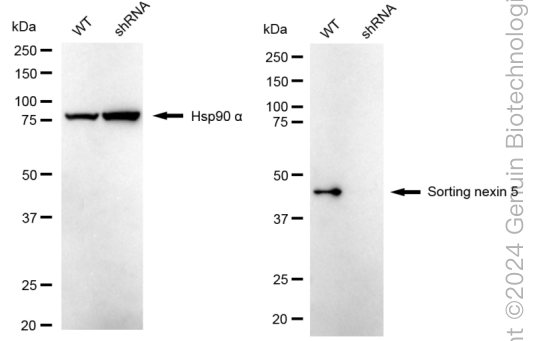 KD-Validated Anti-Sorting Nexin 5 Rabbit Monoclonal Antibody ABG1740