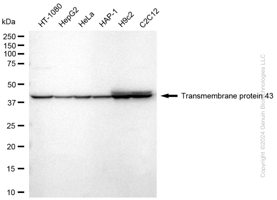 KD-Validated Anti-Transmembrane Protein 43 Rabbit Monoclonal Antibody ABG1741