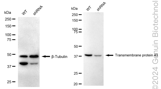 KD-Validated Anti-Transmembrane Protein 43 Rabbit Monoclonal Antibody ABG1741