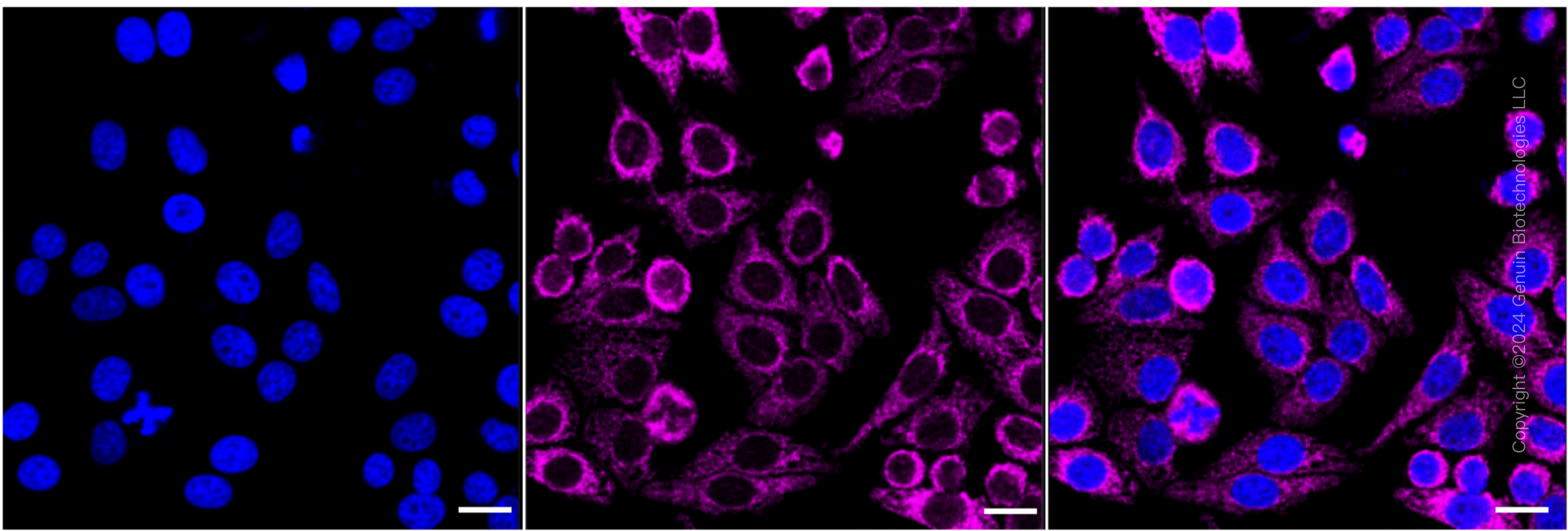 KD-Validated Anti-Versican Rabbit Monoclonal Antibody ABG1743