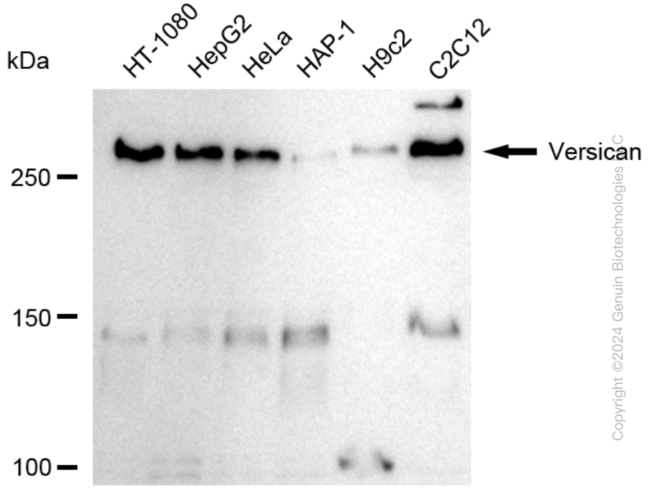 KD-Validated Anti-Versican Rabbit Monoclonal Antibody ABG1743