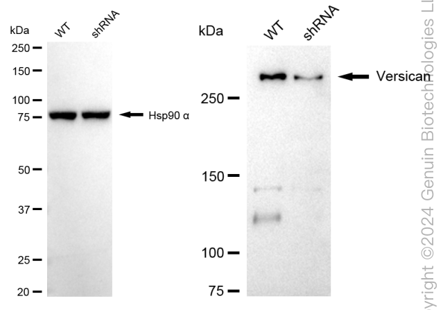 KD-Validated Anti-Versican Rabbit Monoclonal Antibody ABG1743