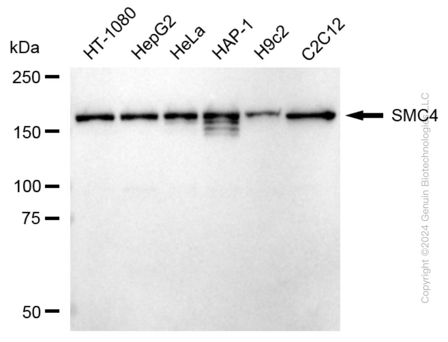 KD-Validated Anti-SMC4 Rabbit Monoclonal Antibody ABG1744