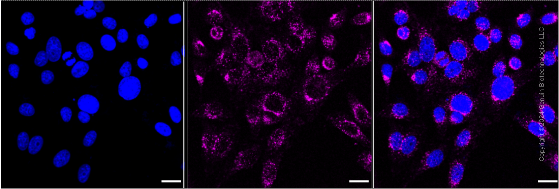 KD-Validated Anti-VPS26 Rabbit Monoclonal Antibody ABG1745