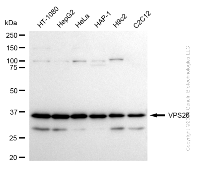 KD-Validated Anti-VPS26 Rabbit Monoclonal Antibody ABG1745