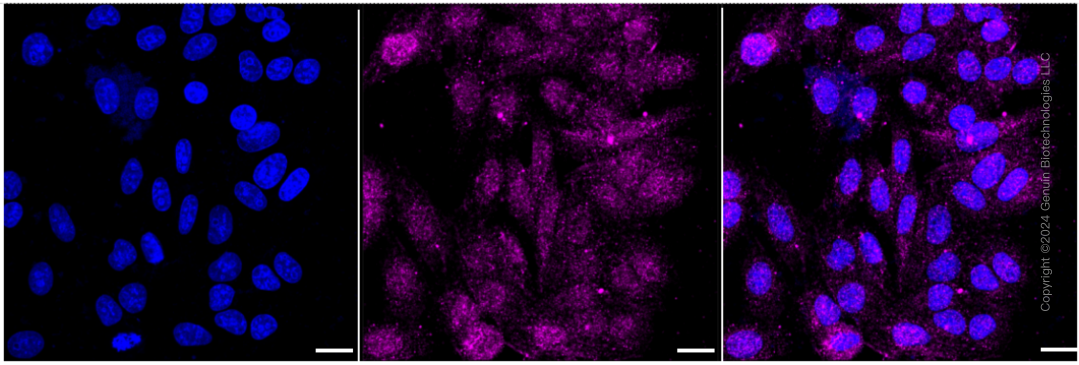 KD-Validated Anti-Ubiquitin Specific Peptidase 5 Rabbit Monoclonal Antibody ABG1747