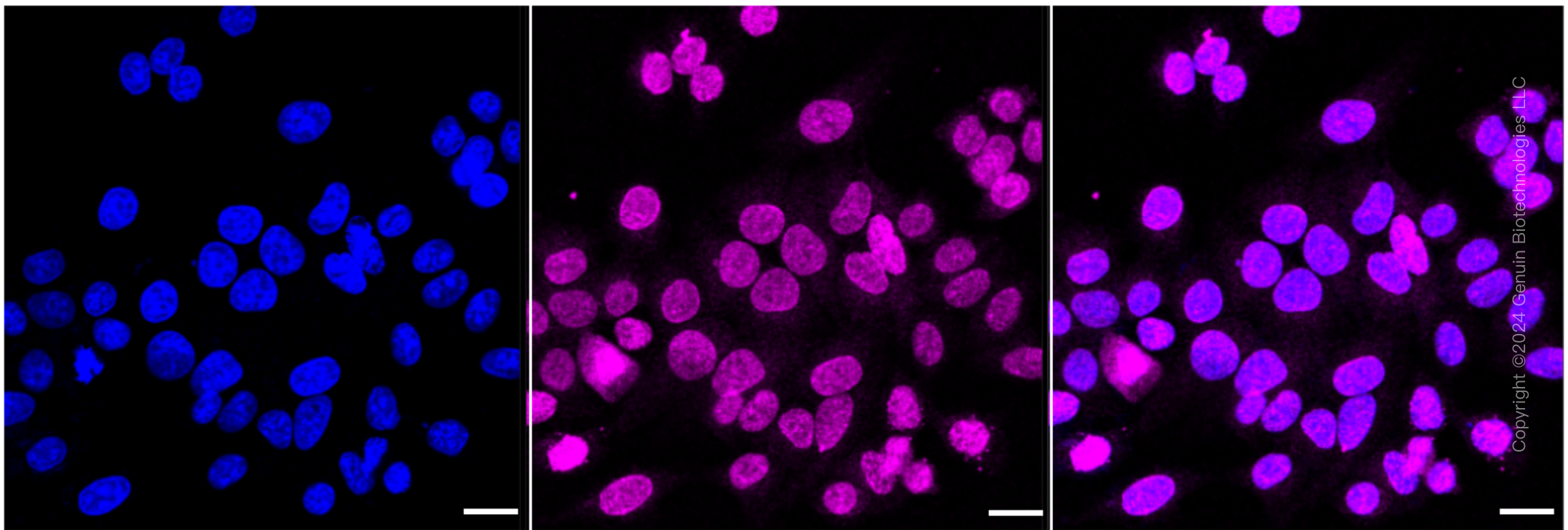 KD-Validated Anti-SUN1 Rabbit Monoclonal Antibody ABG1750