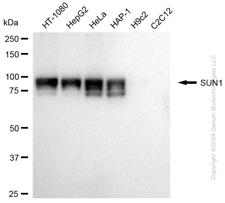 KD-Validated Anti-SUN1 Rabbit Monoclonal Antibody ABG1750