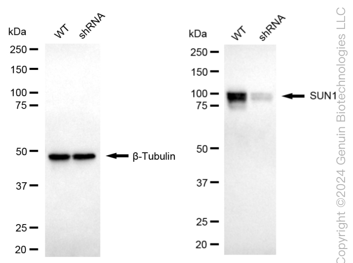 KD-Validated Anti-SUN1 Rabbit Monoclonal Antibody ABG1750