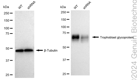 KD-Validated Anti-Trophoblast Glycoprotein Rabbit Monoclonal Antibody ABG1753