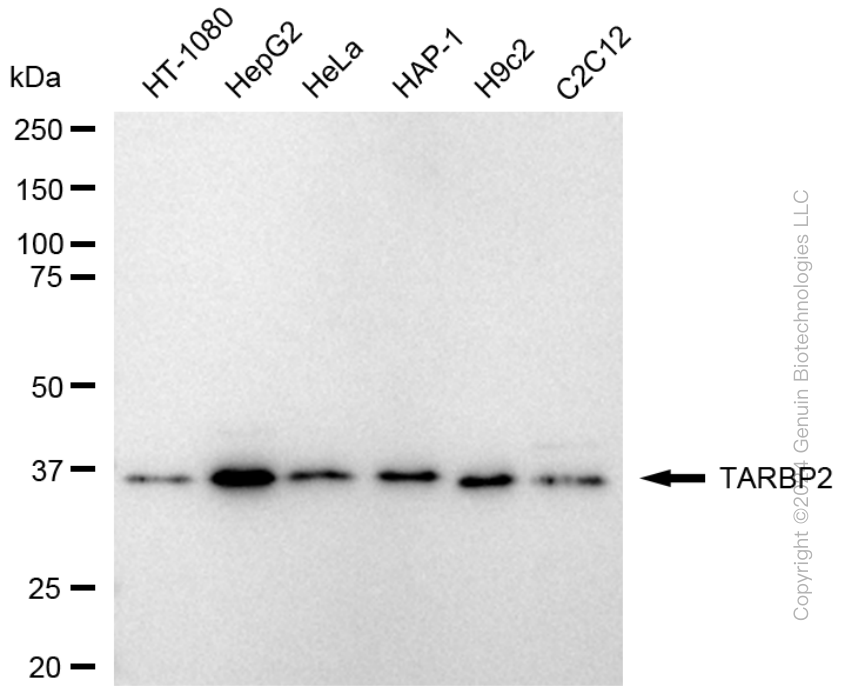 KD-Validated Anti-TARBP2 Rabbit Monoclonal Antibody ABG1754