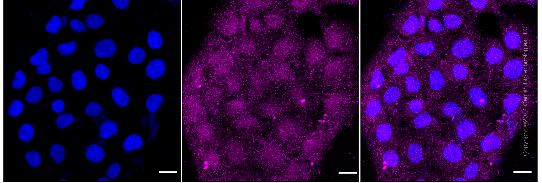 KD-Validated Anti-UBR5 Rabbit Monoclonal Antibody ABG1756