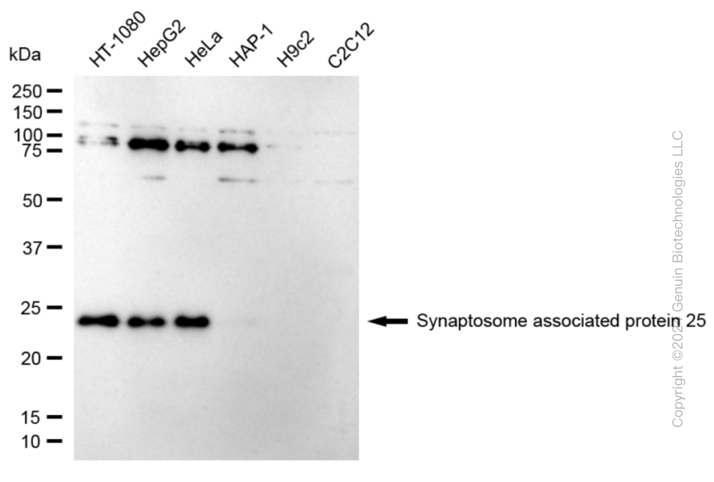 KD-Validated Anti-Synaptosome Associated Protein 25 Rabbit Monoclonal Antibody ABG1757