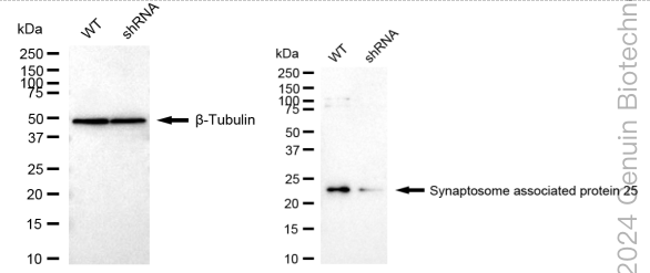KD-Validated Anti-Synaptosome Associated Protein 25 Rabbit Monoclonal Antibody ABG1757