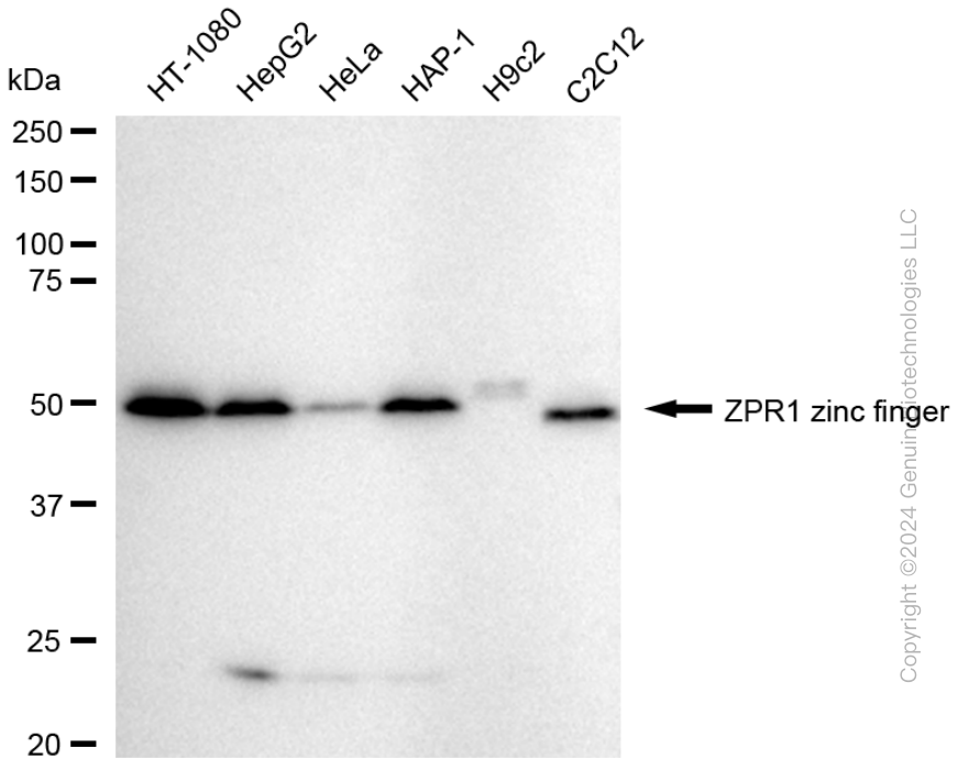 KD-Validated Anti-ZPR1 Zinc Finger Rabbit Monoclonal Antibody ABG1758