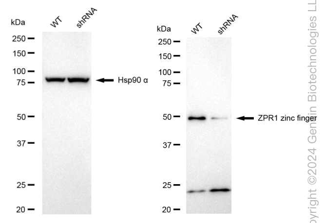 KD-Validated Anti-ZPR1 Zinc Finger Rabbit Monoclonal Antibody ABG1758