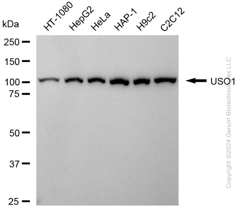 KD-Validated Anti-USO1 Vesicle Transport Factor Rabbit Monoclonal Antibody ABG1760