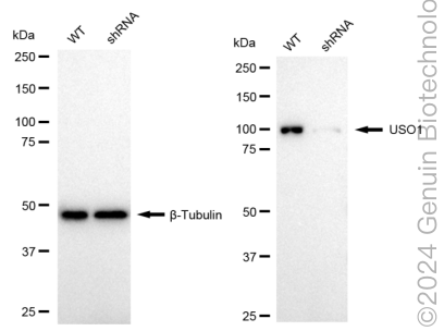 KD-Validated Anti-USO1 Vesicle Transport Factor Rabbit Monoclonal Antibody ABG1760