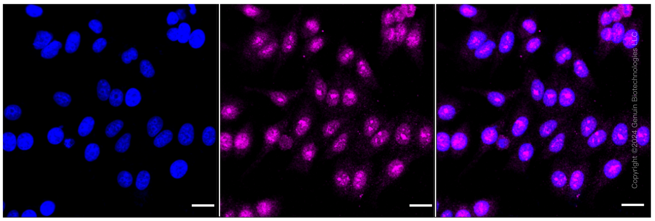 KD-Validated Anti-THO Complex Subunit 1 Rabbit Monoclonal Antibody ABG1763