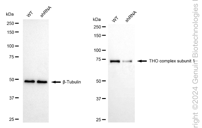 KD-Validated Anti-THO Complex Subunit 1 Rabbit Monoclonal Antibody ABG1763