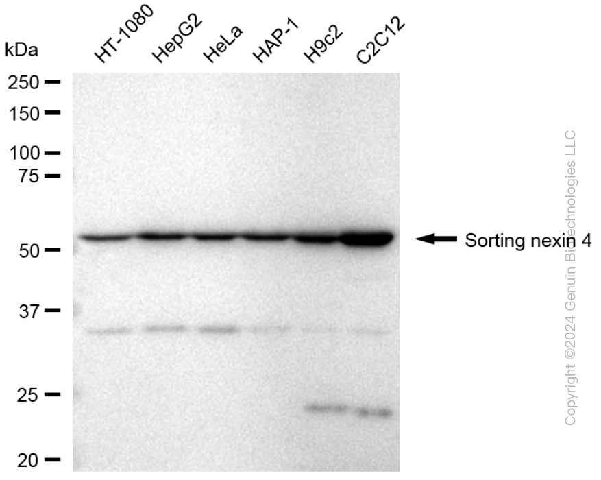 KD-Validated Anti-Sorting Nexin 4 Rabbit Monoclonal Antibody ABG1764