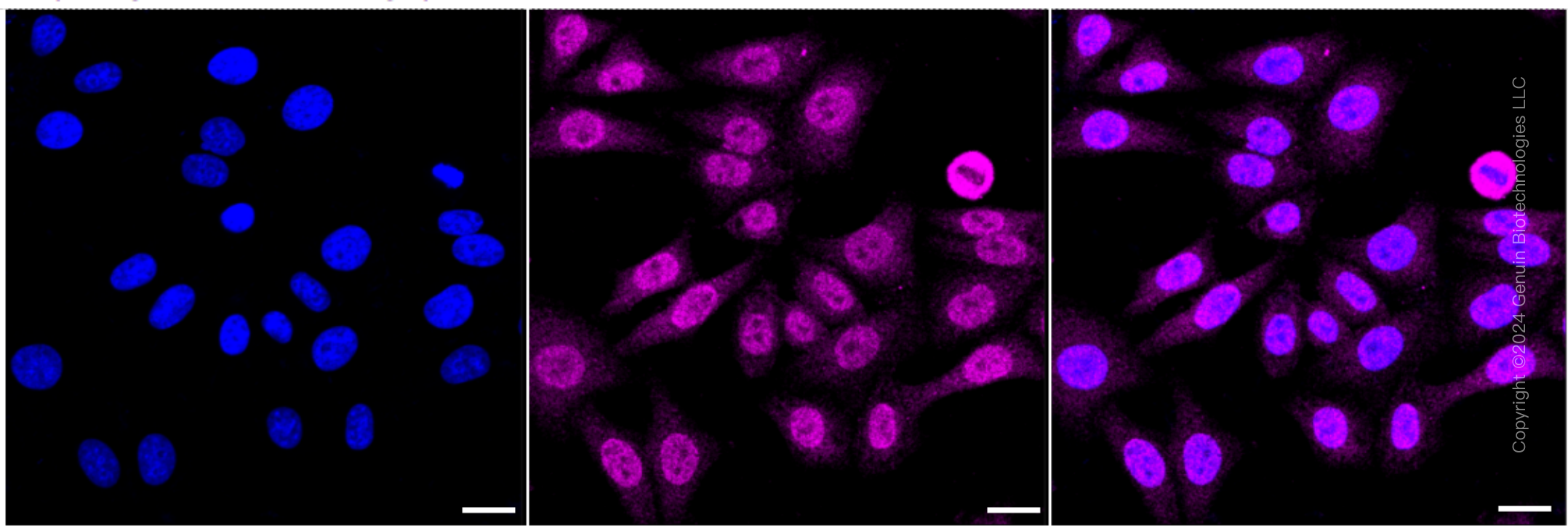KD-Validated Anti-SMCHD1 Rabbit Monoclonal Antibody ABG1765