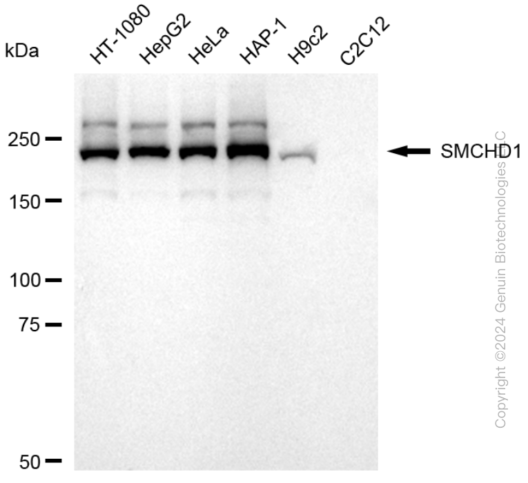 KD-Validated Anti-SMCHD1 Rabbit Monoclonal Antibody ABG1765