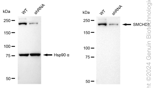 KD-Validated Anti-SMCHD1 Rabbit Monoclonal Antibody ABG1765