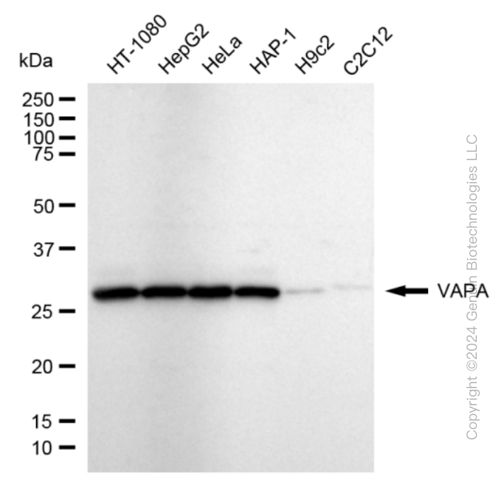 KD-Validated Anti-VAMP Associated Protein A Rabbit Monoclonal Antibody ABG1766
