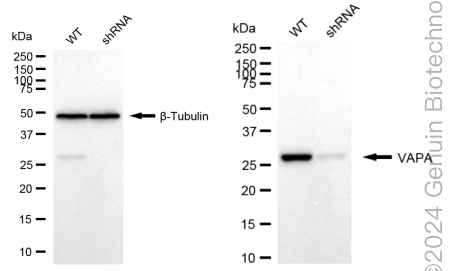 KD-Validated Anti-VAMP Associated Protein A Rabbit Monoclonal Antibody ABG1766