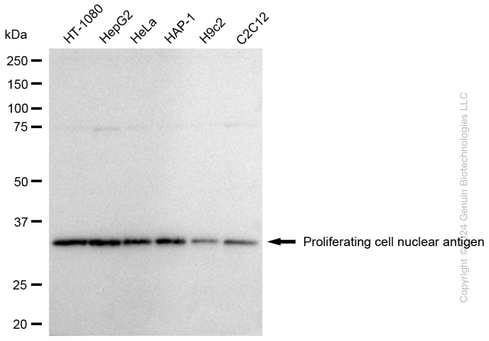KD-Validated Anti-Proliferating Cell Nuclear Antigen Rabbit Polyclonal Antibody ABG1774