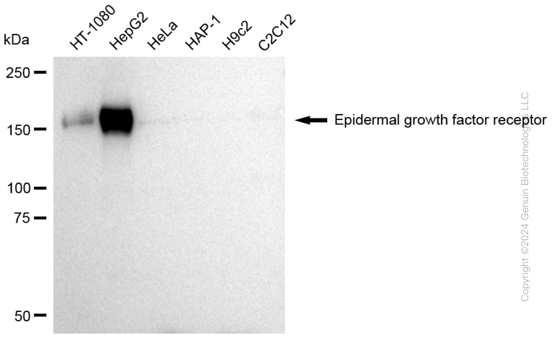 KD-Validated Anti-Epidermal Growth Factor Receptor Rabbit Polyclonal Antibody ABG1775