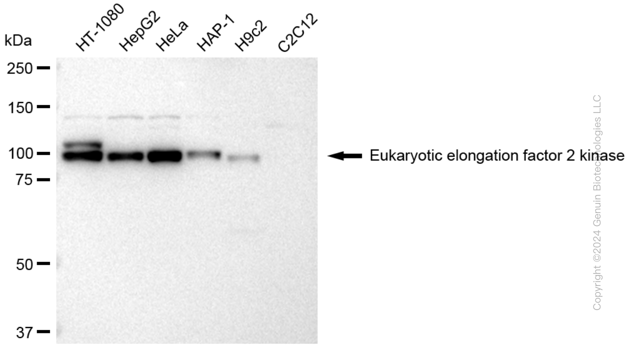 KD-Validated Anti-EEF2K Rabbit Polyclonal Antibody ABG1776