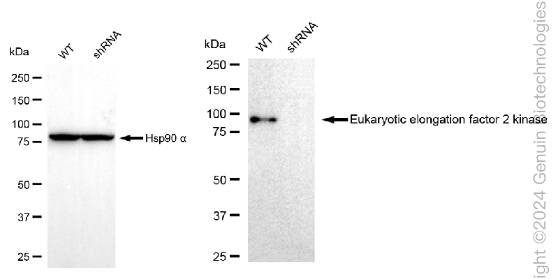 KD-Validated Anti-EEF2K Rabbit Polyclonal Antibody ABG1776