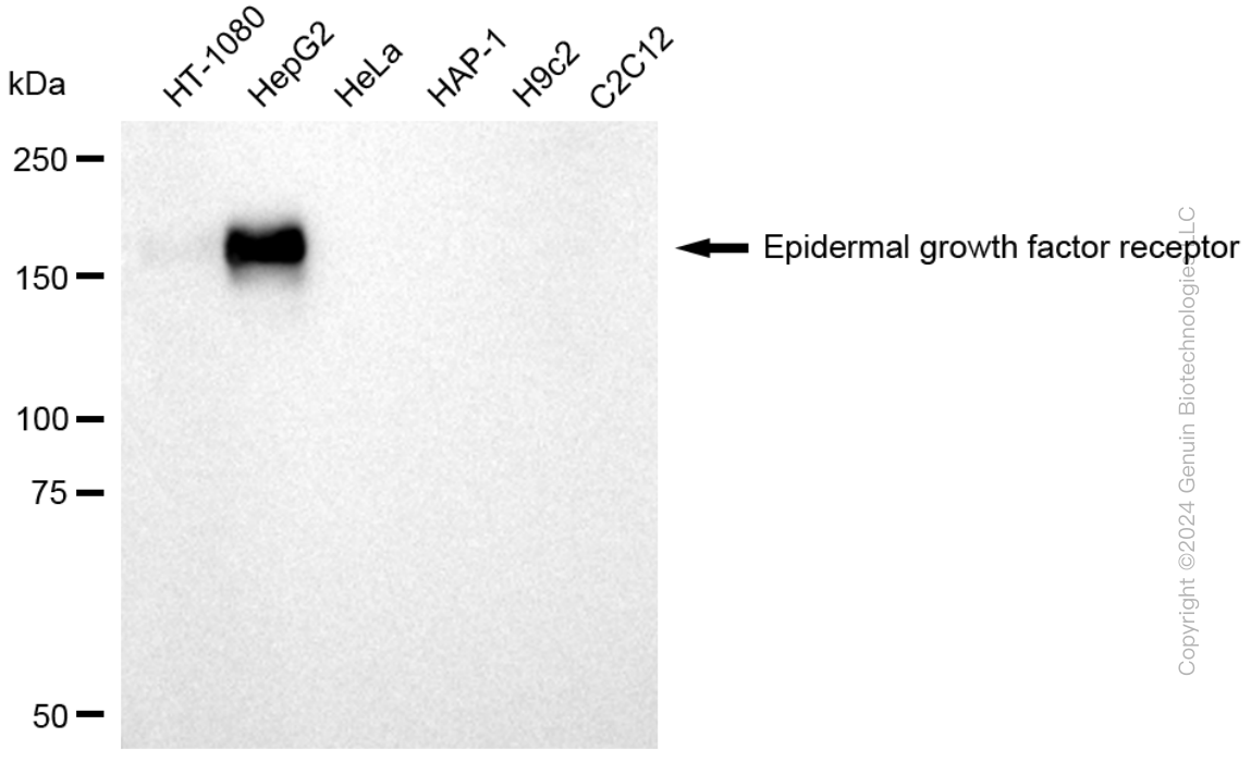 KD-Validated Anti-Epidermal Growth Factor Receptor Rabbit Polyclonal Antibody ABG1778