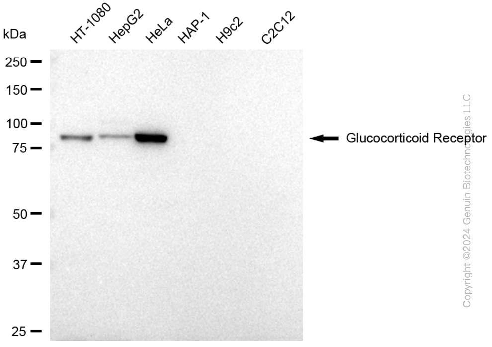 KD-Validated Anti-NR3C1 Mouse Monoclonal Antibody ABG1779