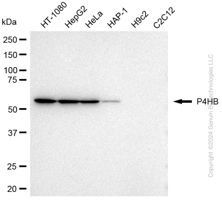 KD-Validated Anti-Prolyl 4-Hydroxylase Subunit Beta Mouse Monoclonal Antibody ABG1780