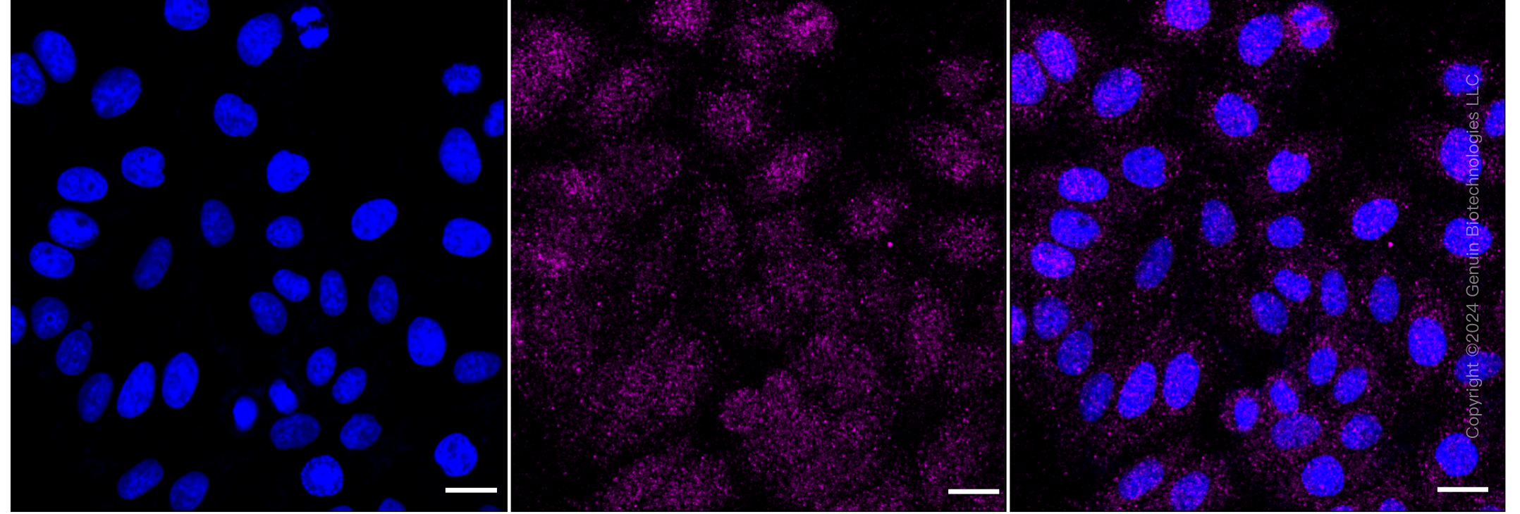 KD-Validated Anti-Cyclin Dependent Kinase 4 Mouse Monoclonal Antibody ABG1782
