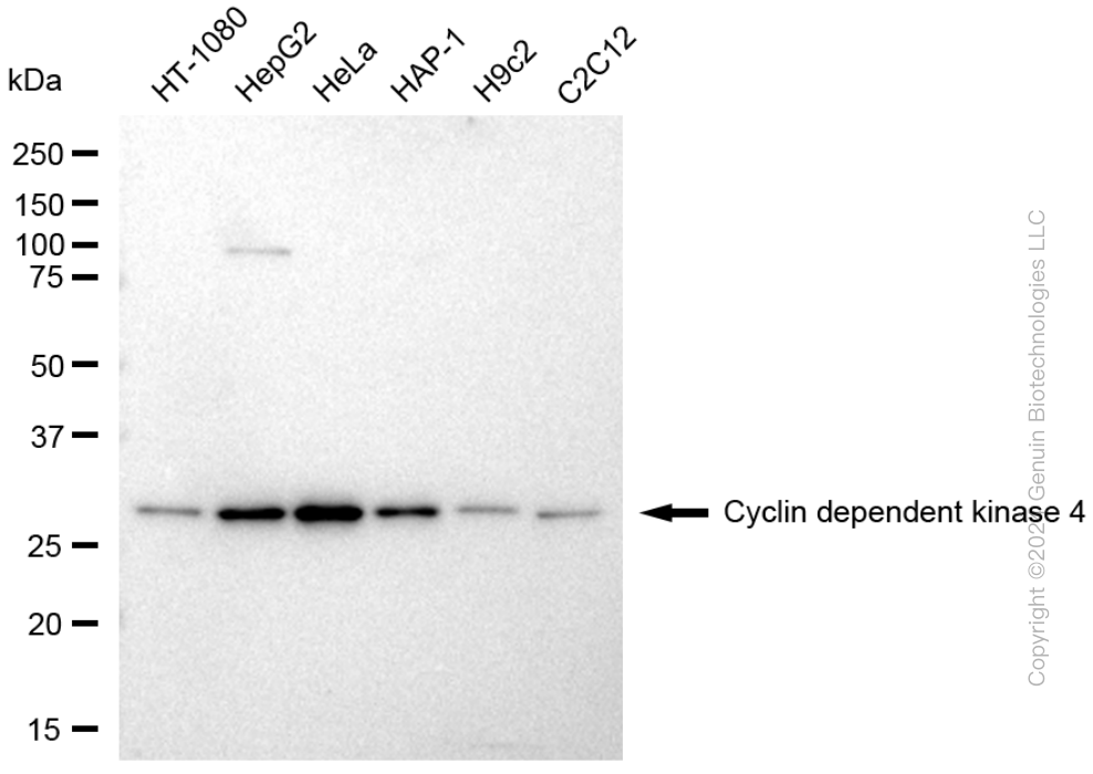 KD-Validated Anti-Cyclin Dependent Kinase 4 Mouse Monoclonal Antibody ABG1782