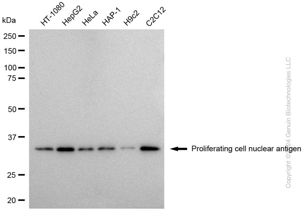 KD-Validated Anti-PCNA Mouse Monoclonal Antibody ABG1784