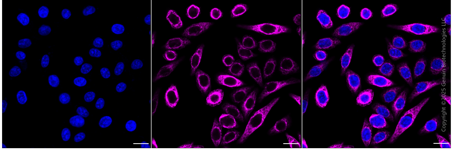 KD-Validated Anti-Keratin 7 Rabbit Monoclonal Antibody ABG1785