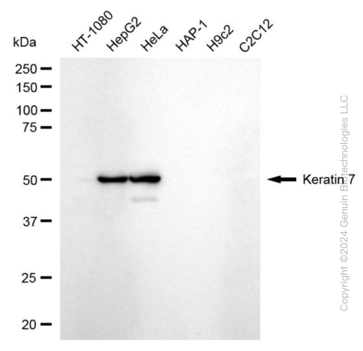 KD-Validated Anti-Keratin 7 Rabbit Monoclonal Antibody ABG1785