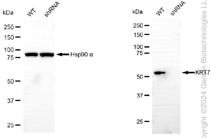 KD-Validated Anti-Keratin 7 Rabbit Monoclonal Antibody ABG1785