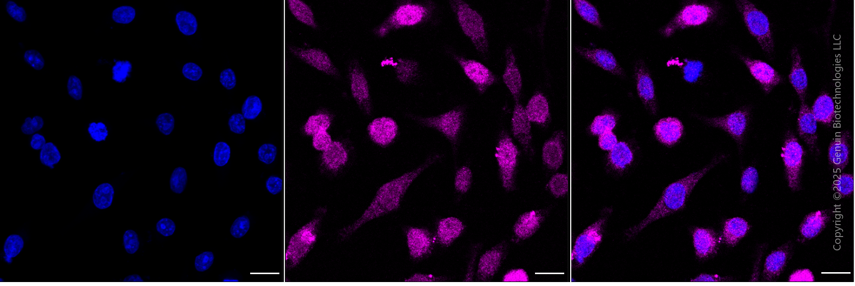 KD-Validated Anti-MITF Mouse Monoclonal Antibody ABG1787