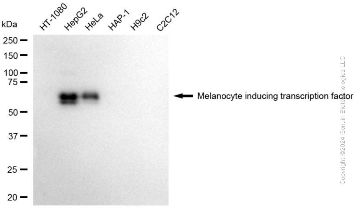 KD-Validated Anti-MITF Mouse Monoclonal Antibody ABG1787